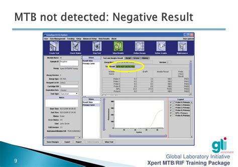 mtb not detected means in tagalog|Appendix 2. Interpretation of Xpert assay results.